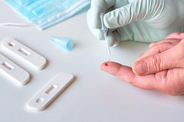 Test covid sangre