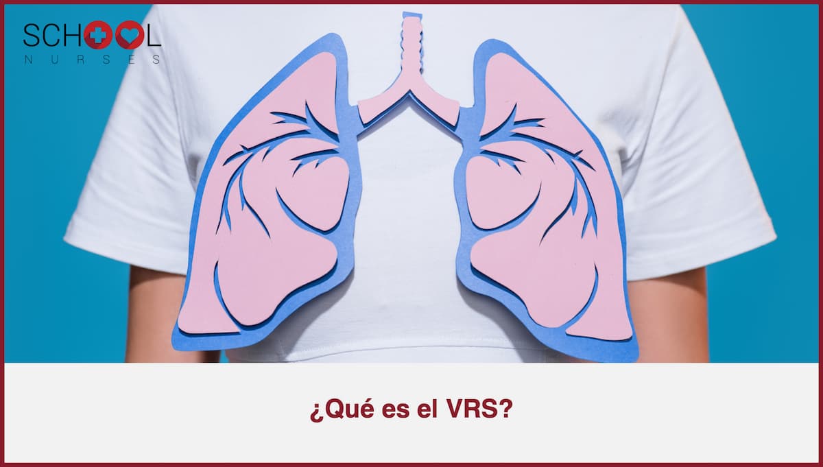Qué es VRS virus respiratorio sincitial